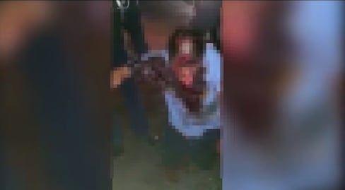 Dos perros "canario corso" atacan a un hombre en Querétaro; lo dejan gravemente herido