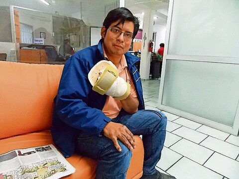 Operan a bombero herido en fuga de gas