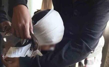 Perros pitbull atacan a niña de 10 años en Ciudad Juárez