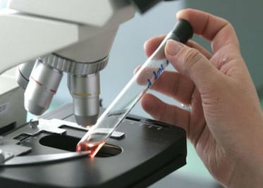 Disminuye edad para contraer VIH