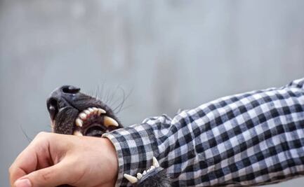 Muere niño de seis años tras ser atacado por un perro en CDMX