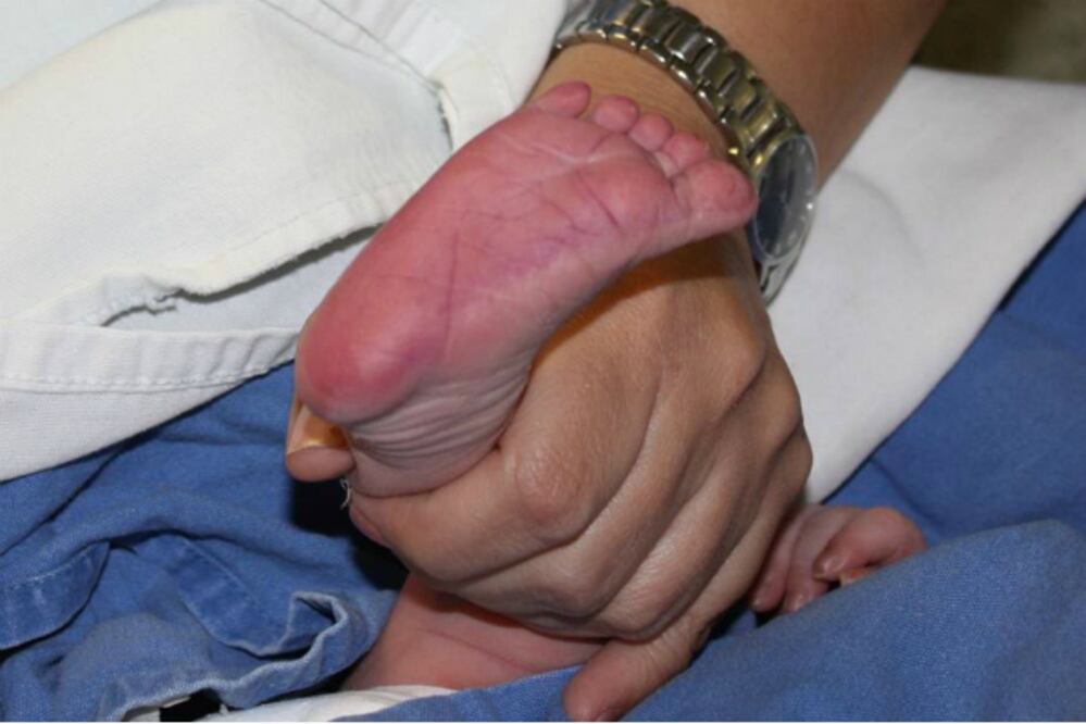 Resaltan importancia de Tamiz Neonatal