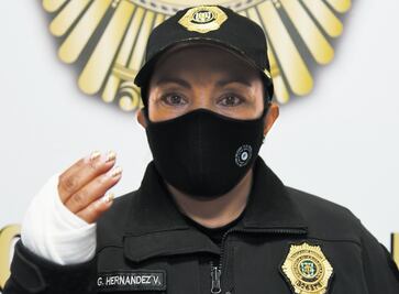 "Me pegaron con un martillo, no les importa darte en la cabeza", dice Atenea herida en marcha