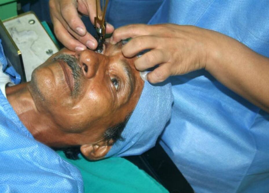 Va Corregidora contra cataratas