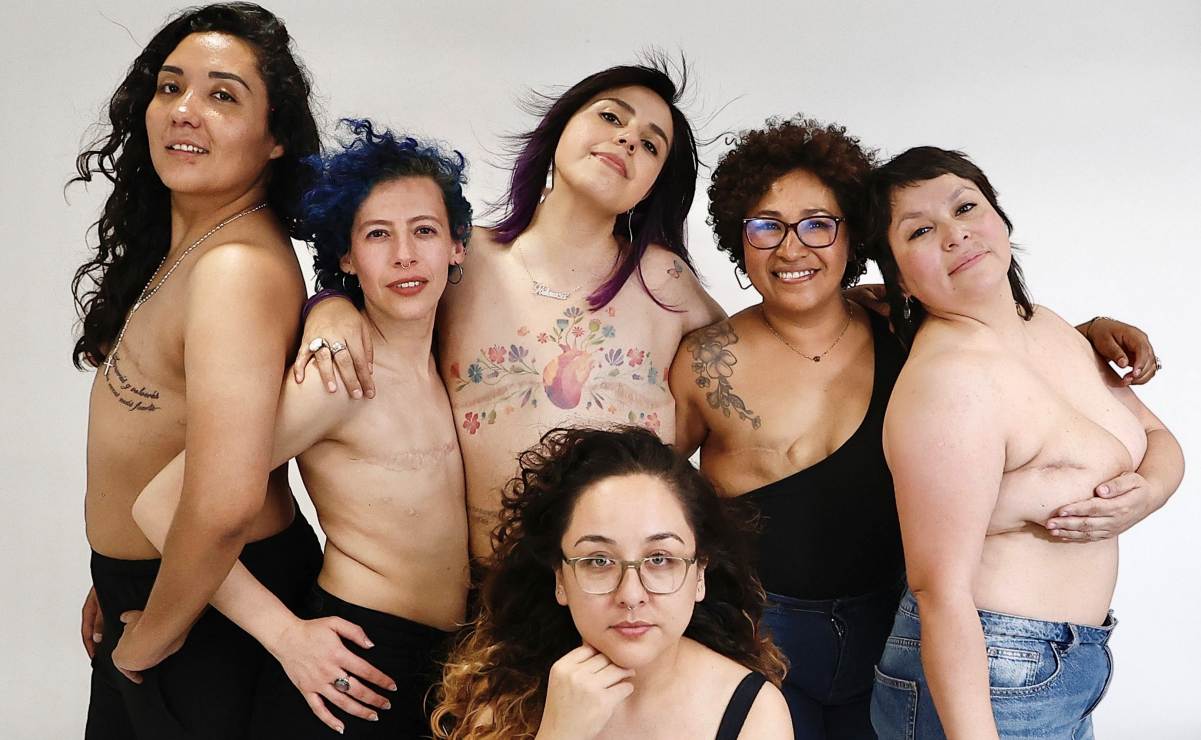 Mastectomía, la dignidad del cuerpo: Sobrevivientes de cáncer de mama enfrentan violencia estética