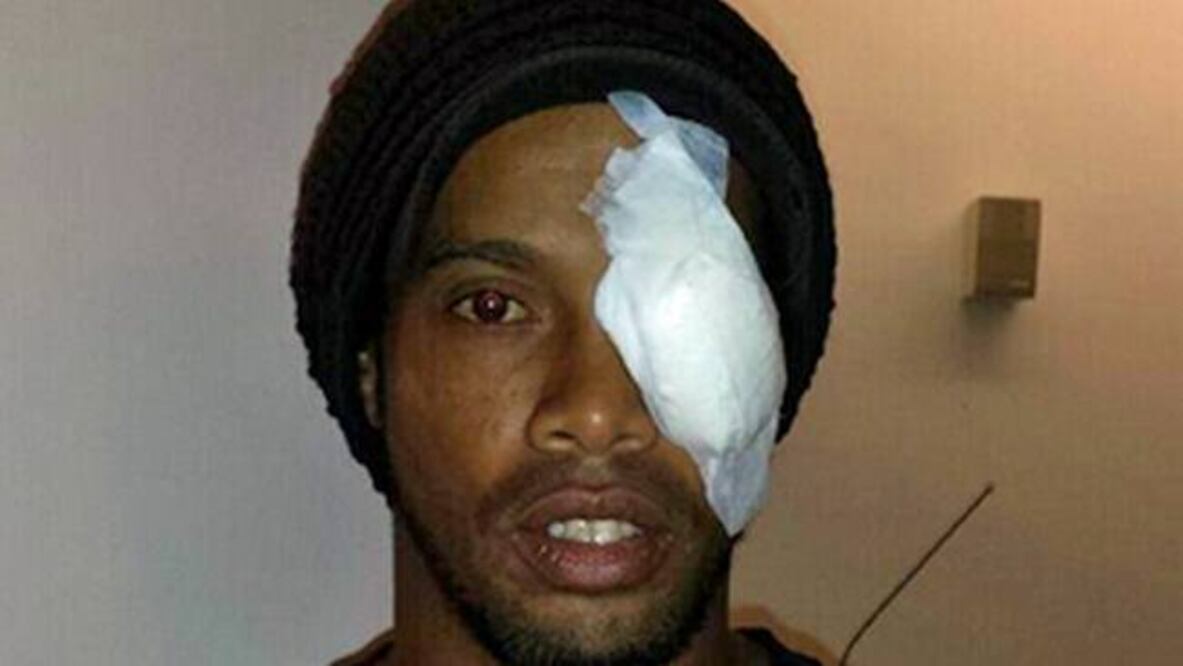 Ronaldinho 'presume' su herida