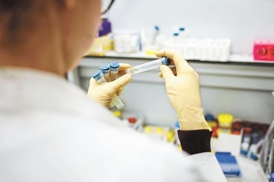 En fin de semana, registran 71 contagios mas de Covid-19 en Querétaro