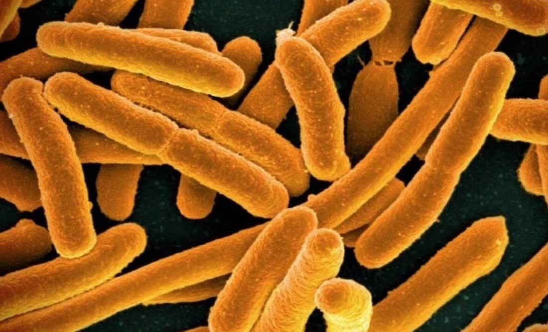 Suman 4 muertos por una bacteria carnívora en Florida; está presente en el mar y puede contraerse al comer mariscos crudos