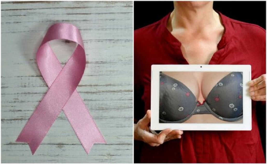 Te decimos cómo hacer un autoexamen mamario y prevenir el cáncer de mama