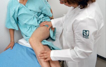 Pasar mucho tiempo sentado o de pie, causas de várices