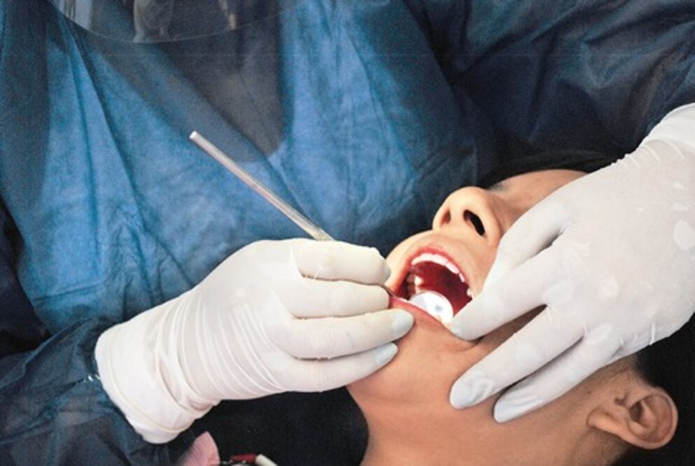 Alertan de caries en niños