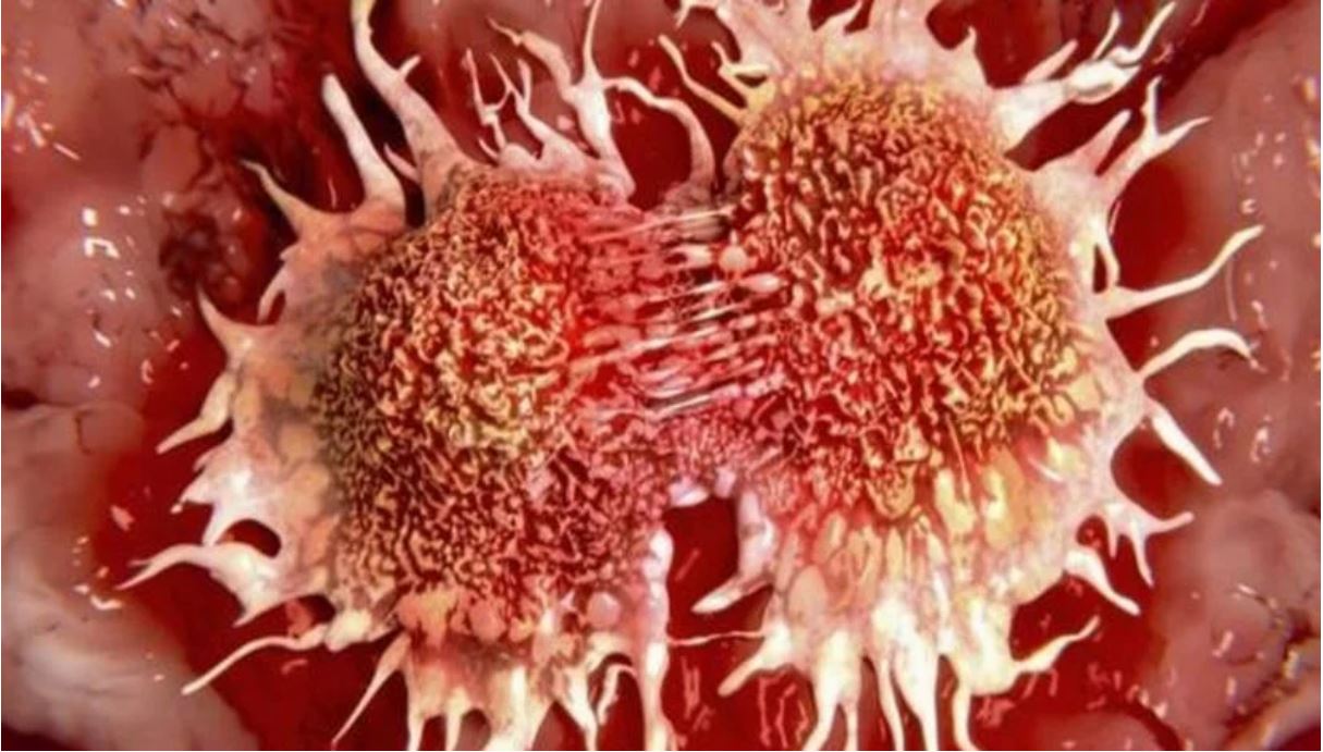 Descubren sustancia que evita la propagación del cáncer
