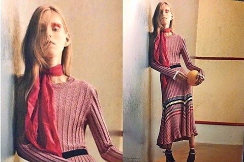 Las imágenes de Lululeika muy delgada generan polémica