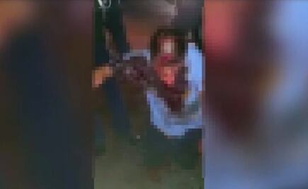 Video. Dos perros "canario corso" atacan a un hombre en Querétaro