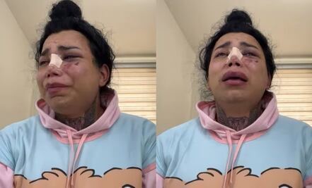 Paola Suárez confiesa aún querer a su novio pese a agresión; "el amor no se termina de un día para otro"