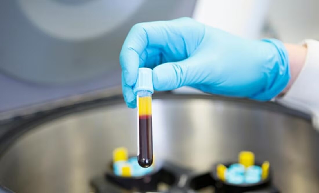 Reportan 150 casos de Metapneumovirus en Sinaloa; no representa un riesgo, dice Secretario de Salud