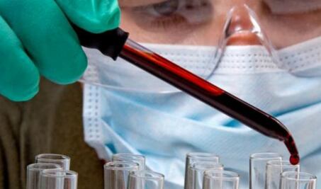 Hay mil 496 casos de SIDA/VIH en Querétaro