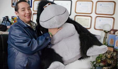 Lupus, enfermedad con alta prevalencia en México