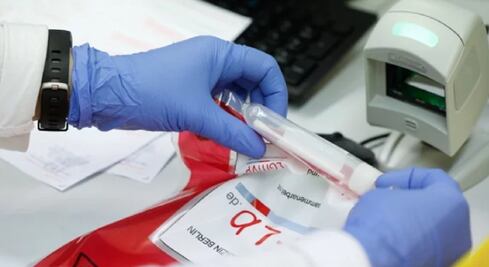 Investigan contagios de personal de salud