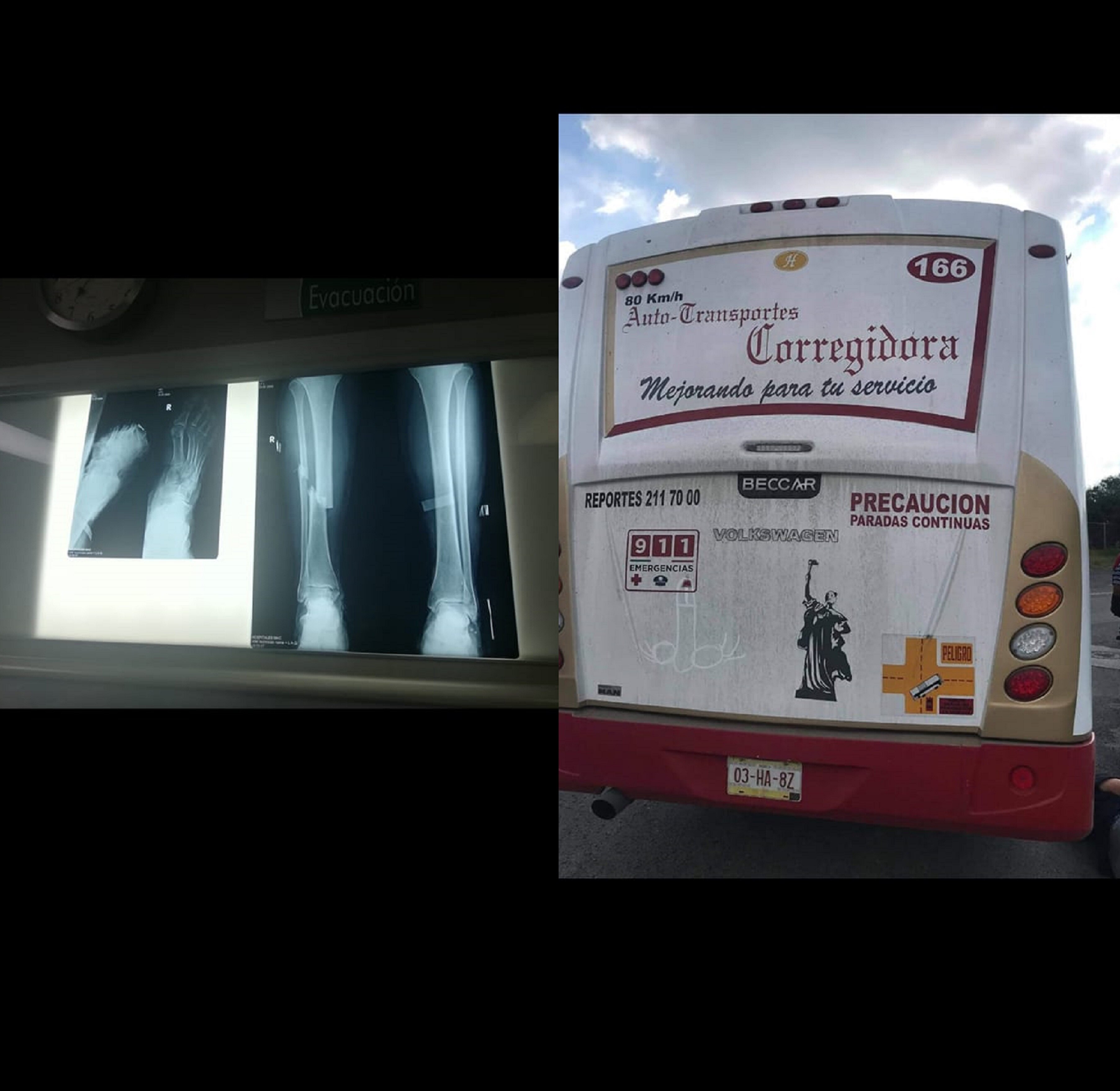 Pide justicia, mujer atropellada por unidad de transporte público en Querétaro