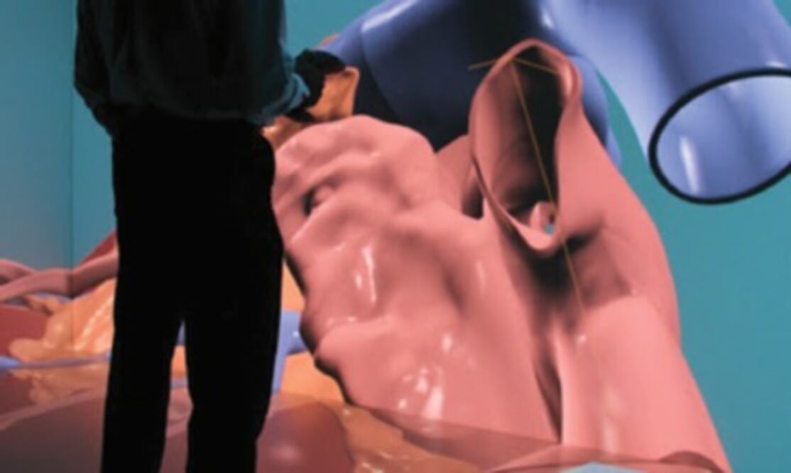 Desarrollos a la mexicana