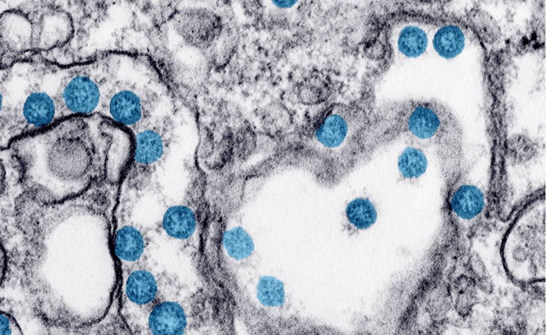 Coronavirus: Este fármaco reduce el riesgo de Covid-19 en un 57%, dice estudio