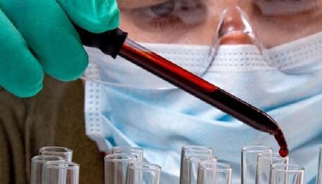 Exhortan a evitar especulación por zika