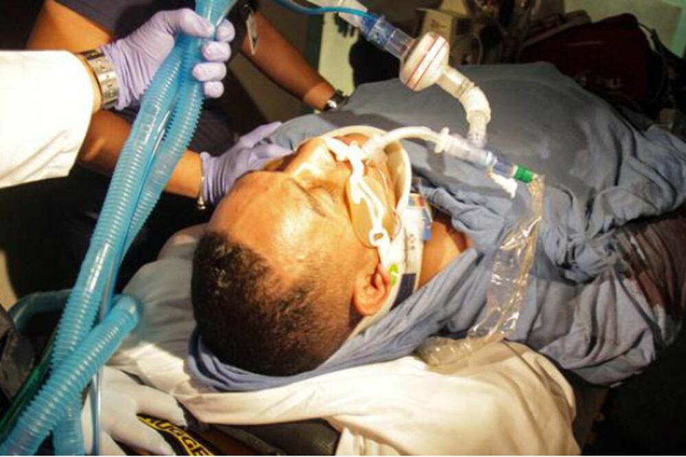 Macho Camacho, con muerte cerebral