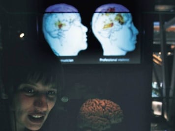 Presentan resultados de Semana del Cerebro