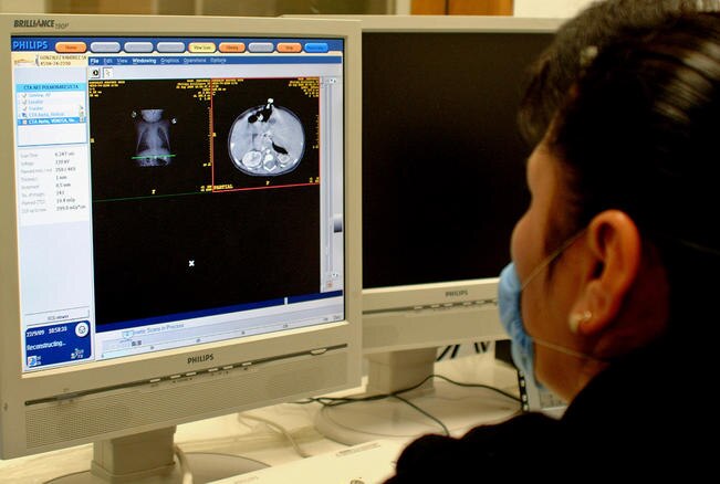 Estudian oxitocina como analgésico en casos de cáncer