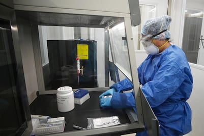 Al día, procesan 140 muestras en el laboratorio estatal