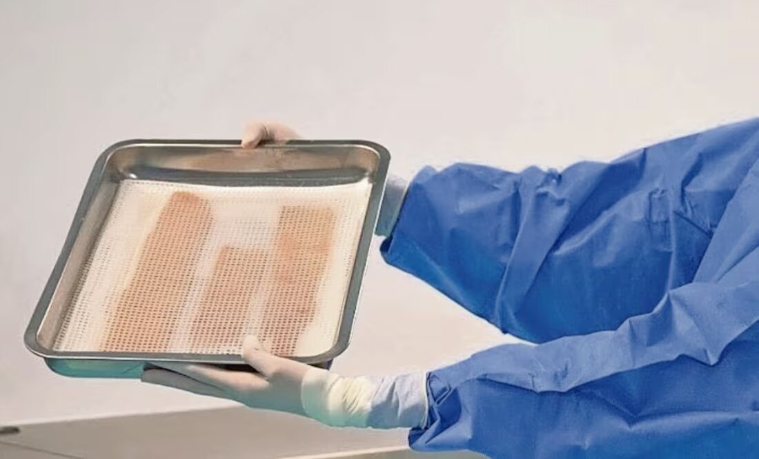 La donación fue hecha por el Banco de Tejidos del Edomex al Instituto Nacional de Rehabilitación. Foto: Especial