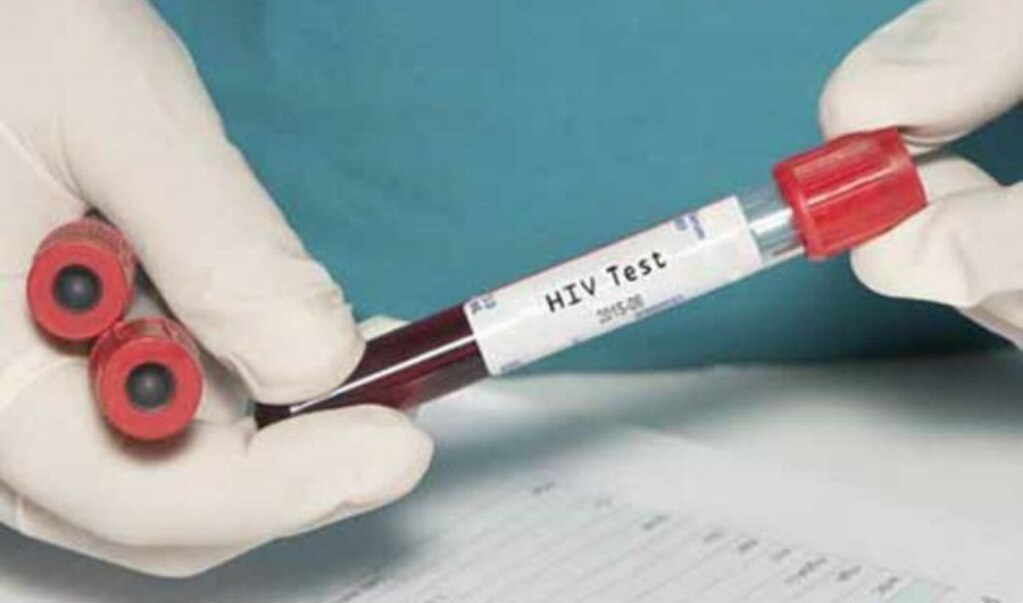 Acusan de asesinato a hombre con VIH por infectar a su novia