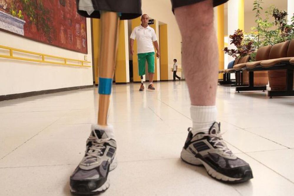 La fabricación con bambú y triplay de madera cubre las necesidades de resistencia y bajo costo para las prótesis (ARCHIVO EL UNIVERSAL)