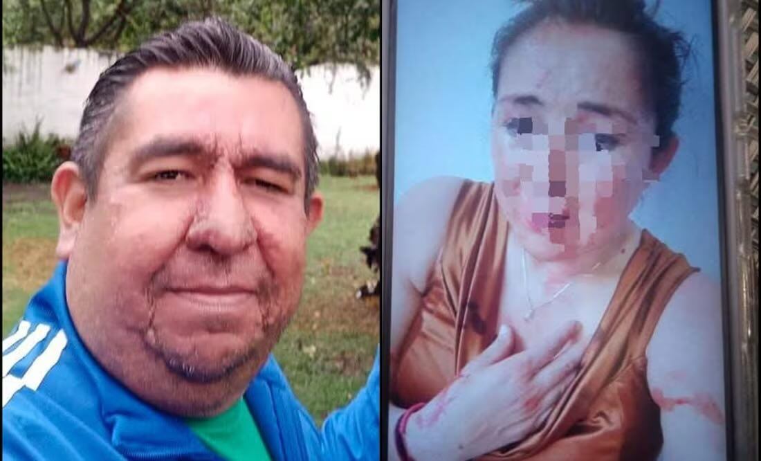 El regidor de Tlaxcala, Alejandro Alonso N., dejó su cargo público para enfrentar a la justicia por golpear a su esposa (13/03/2025). Foto: Especial