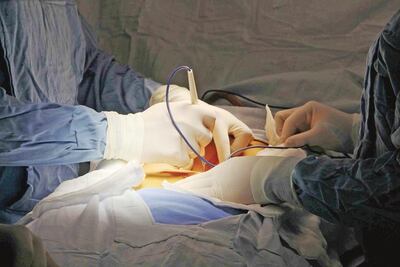 Buscan bajar 35% el proceso de cesárea en hospital de SJR