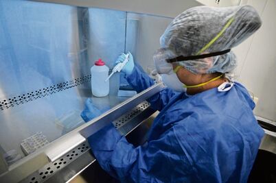 En casi 14 meses,  reportan sólo 30 casos de viruela símica en Querétaro