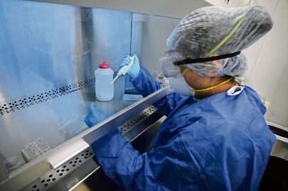 En casi 14 meses, reportan sólo 30 casos de viruela símica en Querétaro