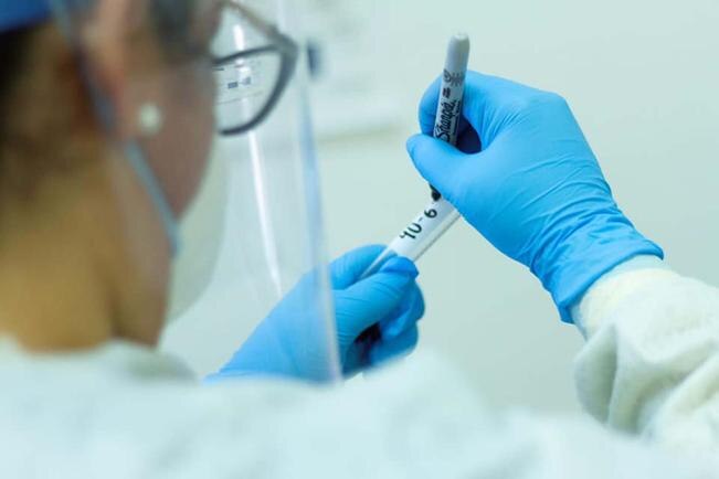 UAQ seguirá buscando recursos para vacuna