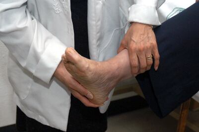 Otorga IMSS más de 86 mil consultas contra la Trombosis 