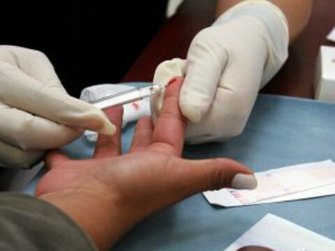 Respetar derechos de portadores de VIH