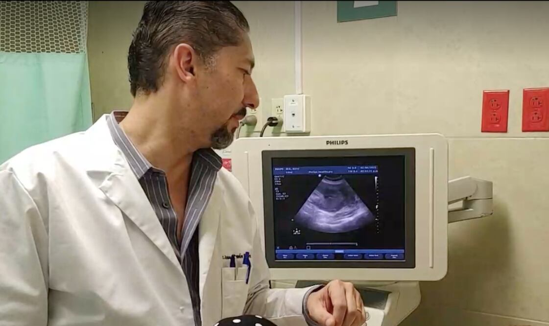 Extraen tumor de 3 kilos en hospital del IMSS Querétaro