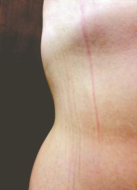 Cuerpos que se transforman