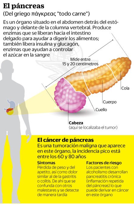 José José, las batallas del Príncipe