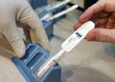 Promueven prueba para detectar VIH
