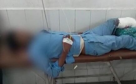 Médicos de la India colocan pierna amputada como almohada