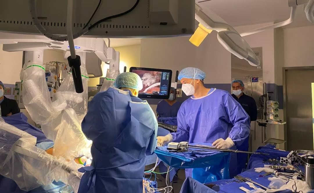 Aspectos del primer trasplante hepático a una menor de tres años, relacionado con hepatectomía asistida por cirugía robótica Da Vinci. Foto: Especial