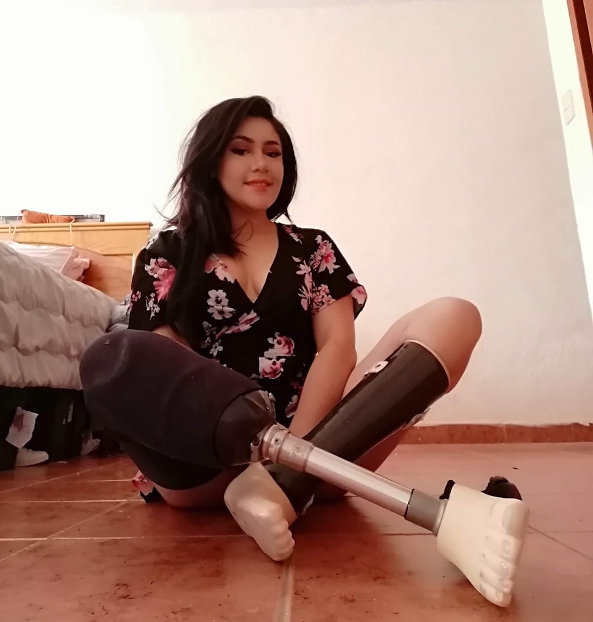 El IMSS Querétaro le ofrece 88 mil pesos, tras amputarle las piernas