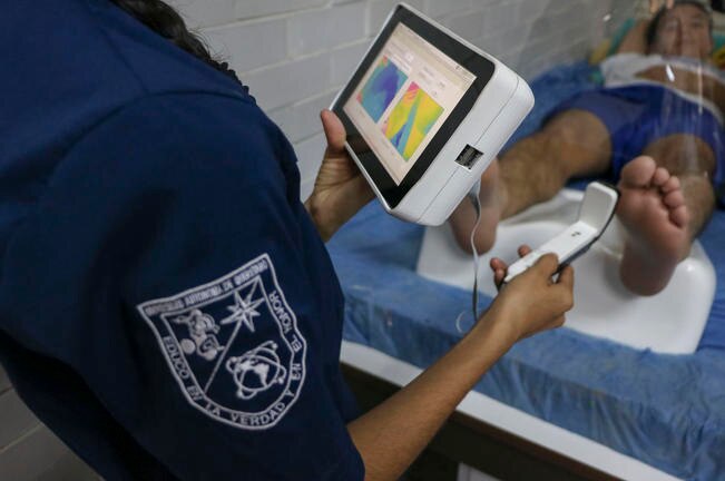 Realizan dispositivo portátil para detectar pie diabético