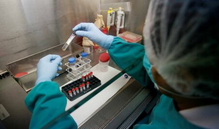 Fortalece Salud medidas contra la tuberculosis